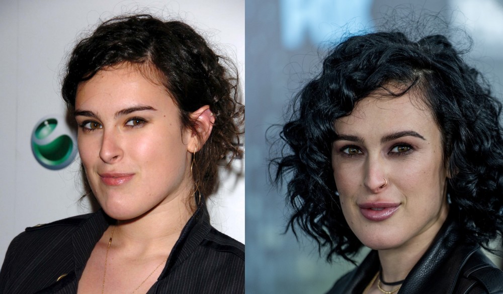 Румер Уиллис – яркий пример того, как удачная ментопластика преображает внешность