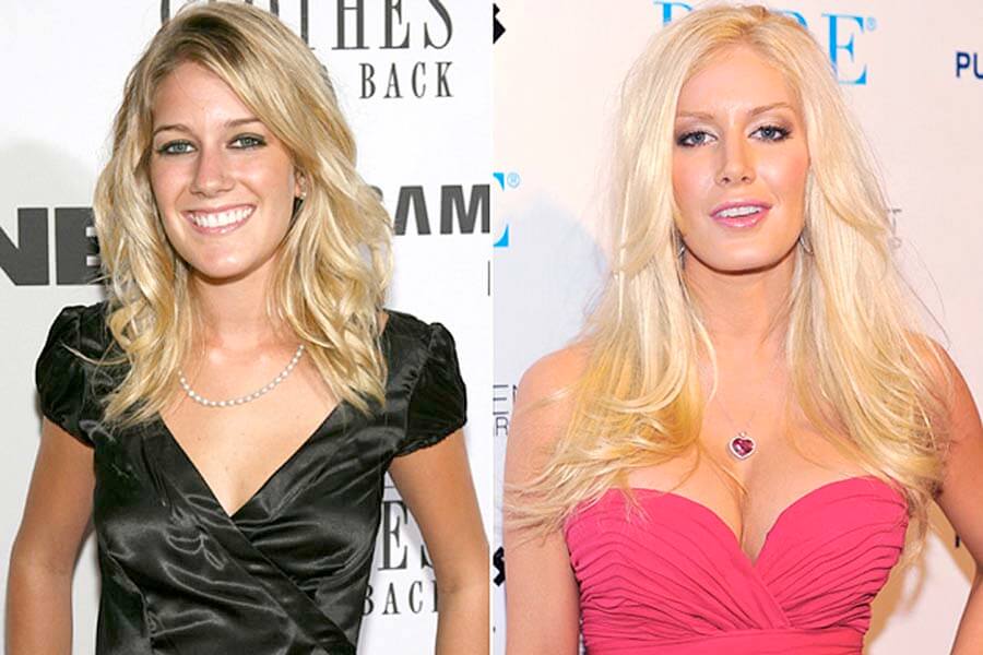 Хайди Монтаг