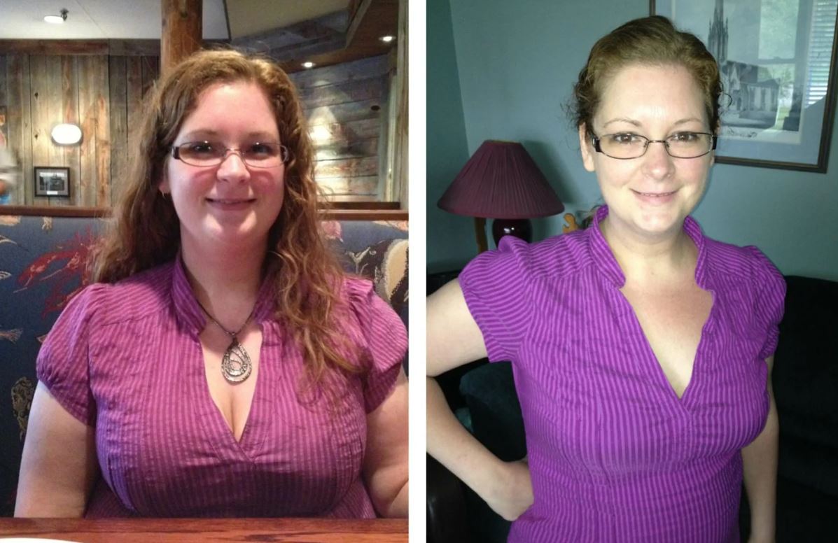 Многие девушки с&nbsp;большой грудью рады избавиться от&nbsp;непосильной ноши огромного бюста