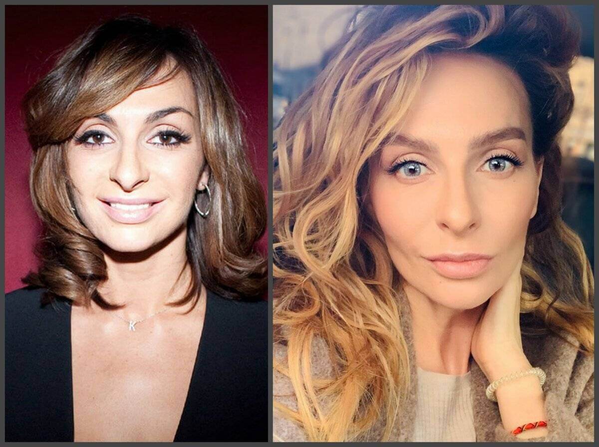 Поговаривают, что Екатерина Варнава пошла на&nbsp;опасную операцию, чтобы стать голубоглазой