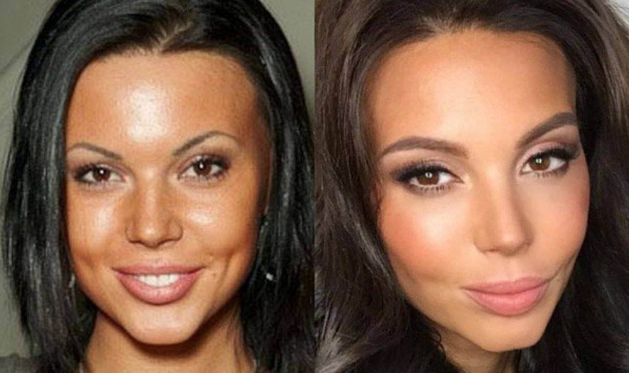 Оксана Самойлова до&nbsp;и&nbsp;после пластики