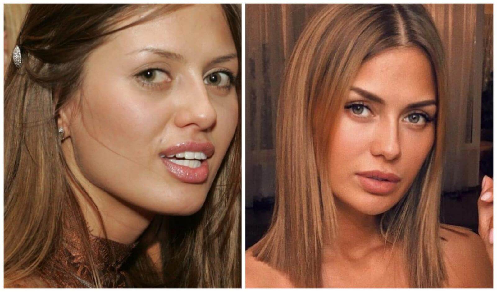 Виктория Боня до&nbsp;и&nbsp;после пластики