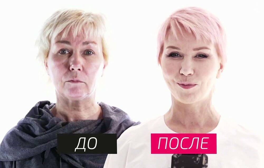 Ксения Стриж до&nbsp;и&nbsp;после пластики