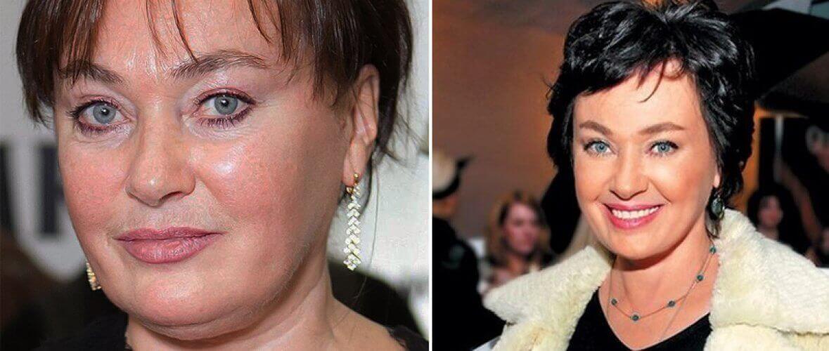 Лариса Гузеева до&nbsp;и&nbsp;после пластики