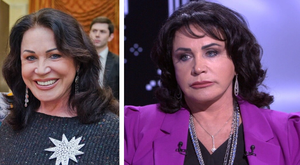 Надежда Бабкина до&nbsp;и&nbsp;после пластики