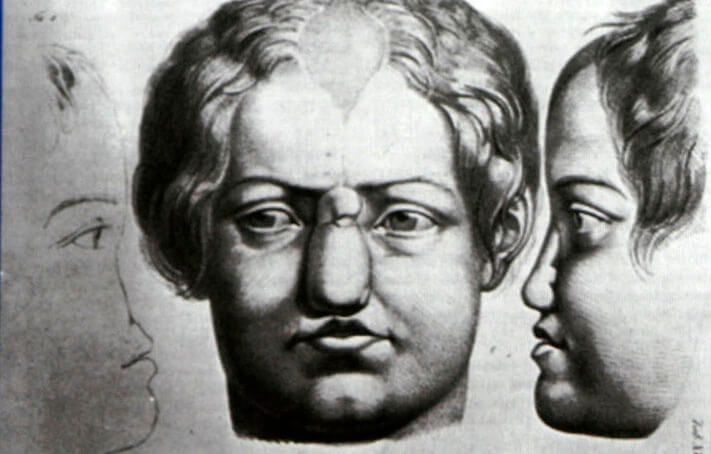 Иллюстрация из&nbsp;первой книги о&nbsp;пластической хирургии