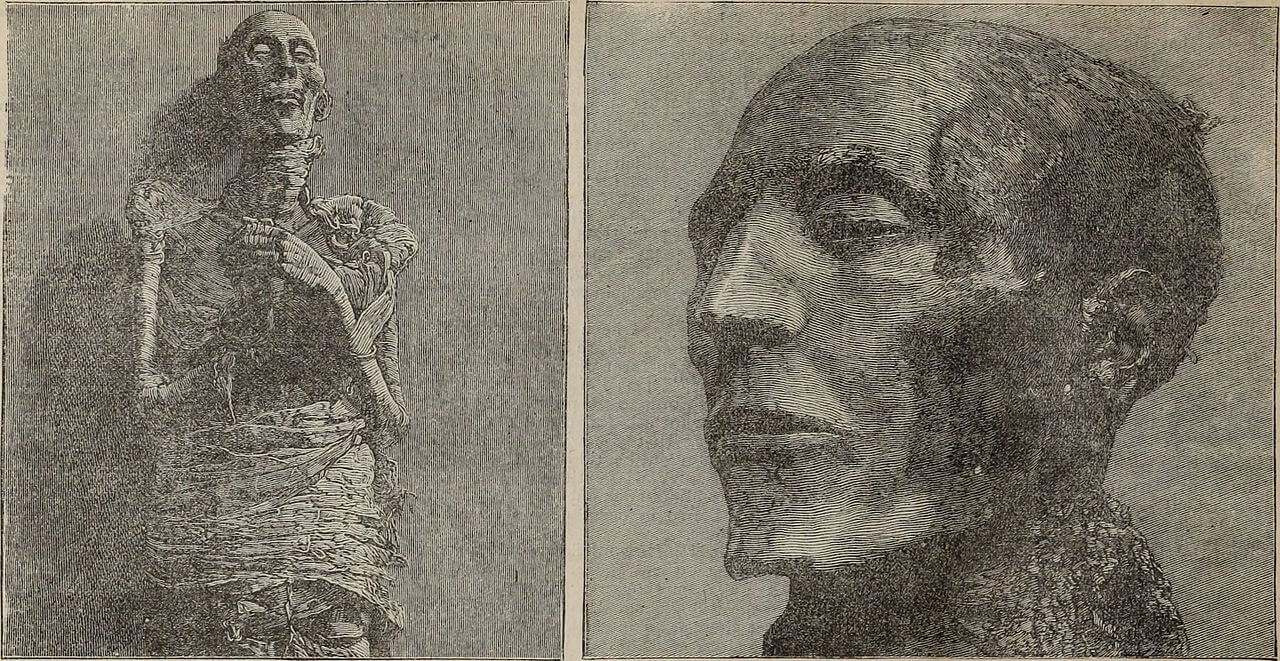 Перед мумификацией тело Рамзеса II подверглось пластической операции