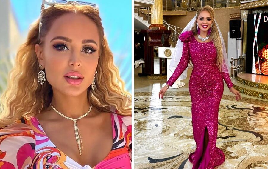 Анна Калашникова предпочитает не скрывать свои обращения к косметологам и пластическим хирургам