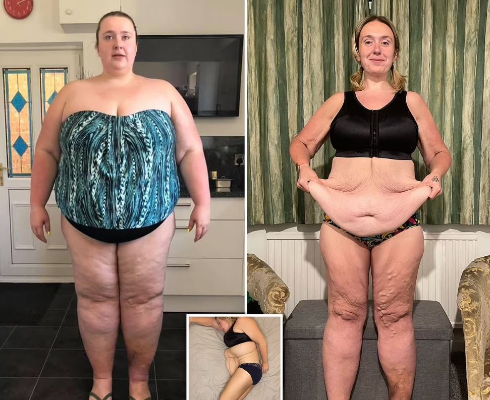 &hellip; но&nbsp;как только человек снимает одежду, все&nbsp;становится совсем не&nbsp;так радужно.