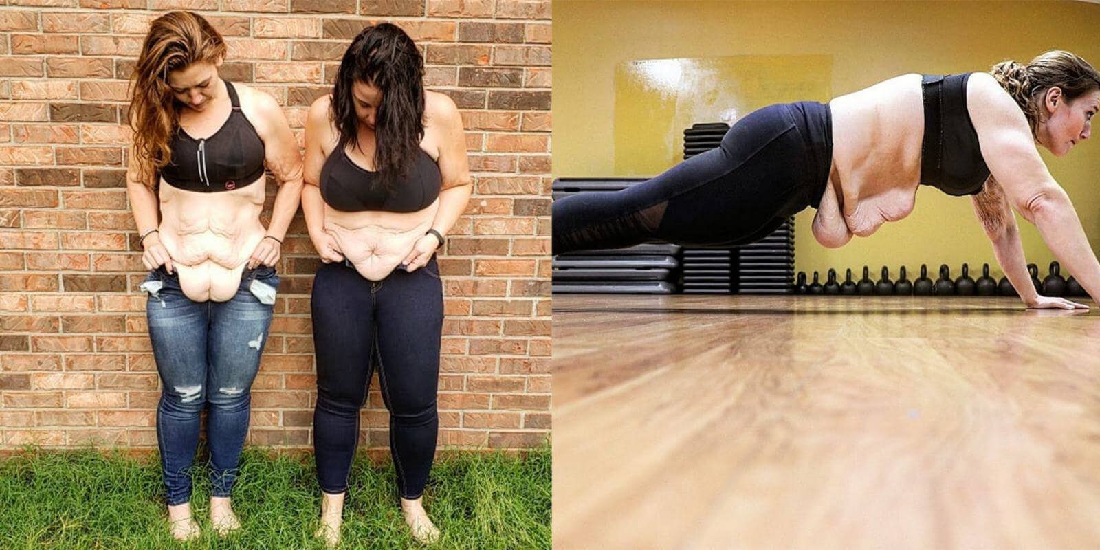 Бороться с&nbsp;последствиями быстрого похудения с&nbsp;помощью спорта и&nbsp;косметологических процедур &ndash; мертвый номер