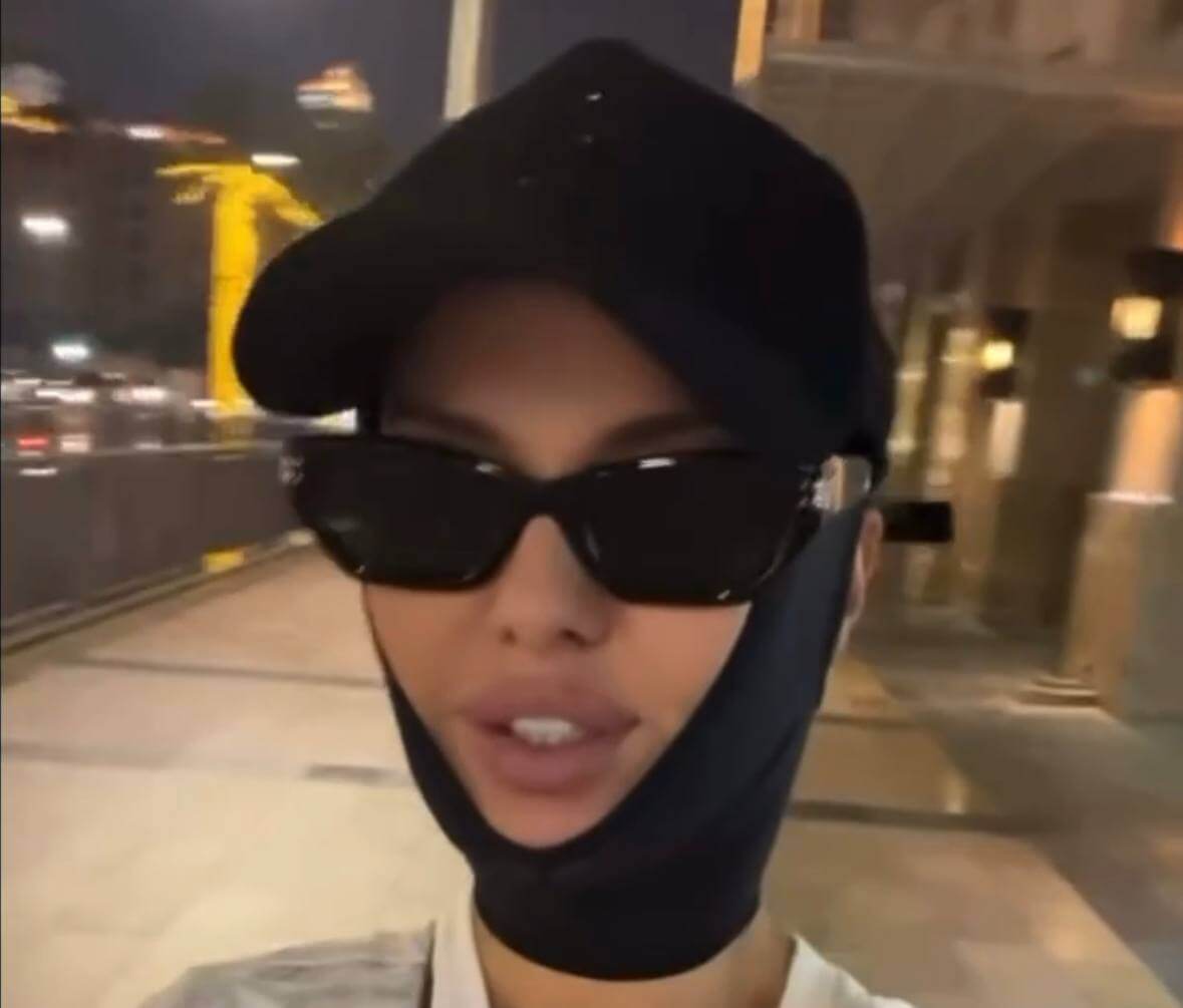 Виктория вышла в эфир практически сразу после операции