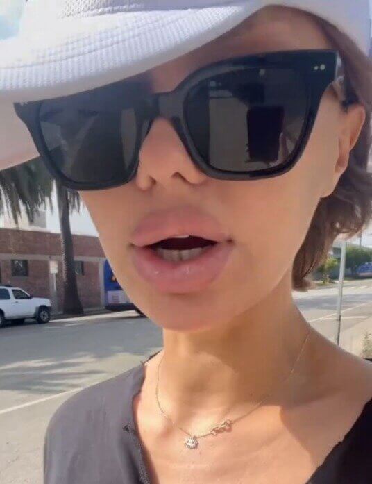 Виктория Боня почти 3 месяца фотографировалась только в&nbsp;черных очках, чтобы не&nbsp;показывать результаты пластики раньше времени