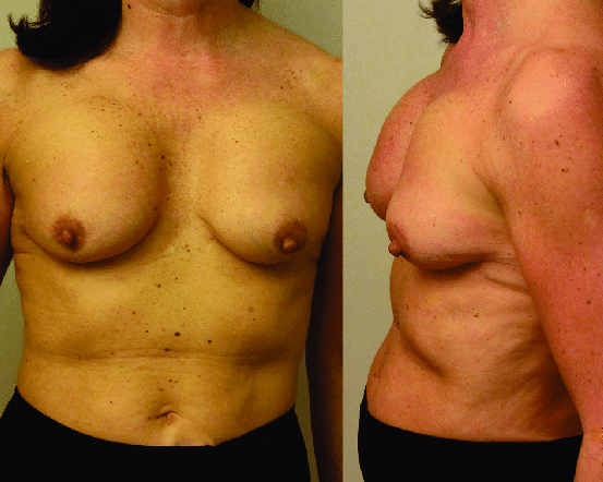 Так выглядит эффект водопада в&nbsp;жизни