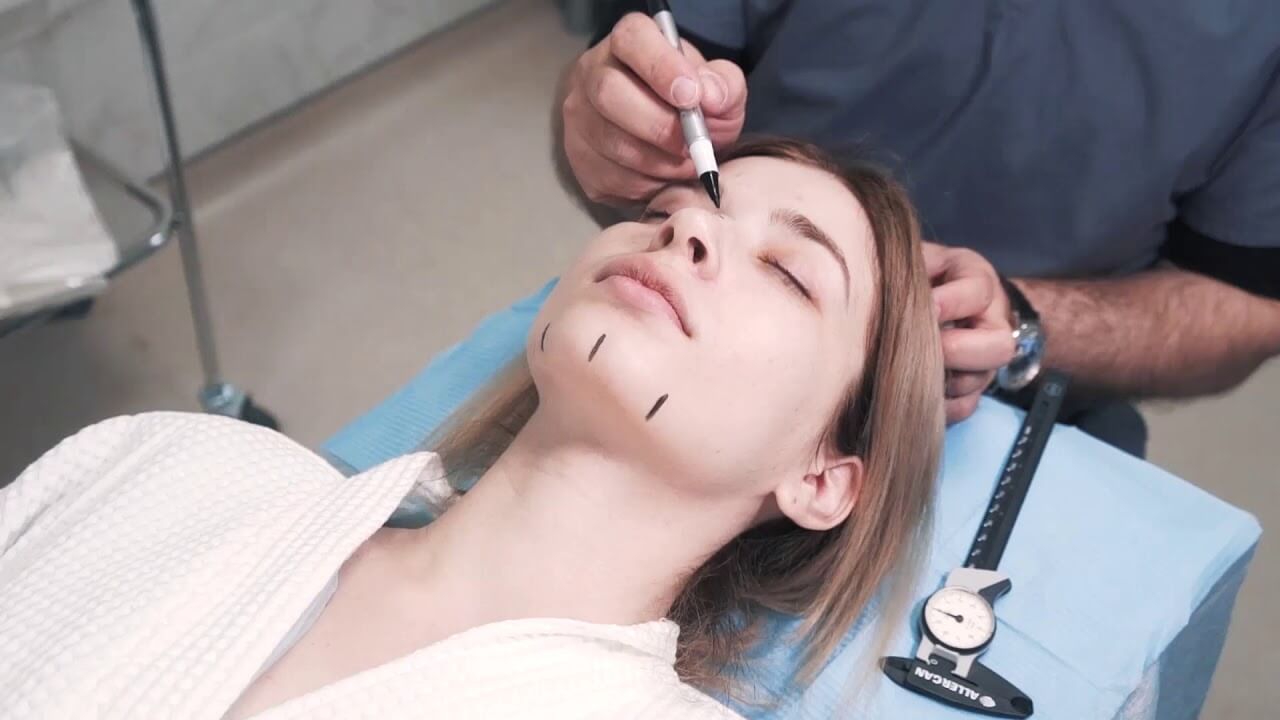 Программу гармонизации лица хирург составляет индивидуально для&nbsp;каждого пациента