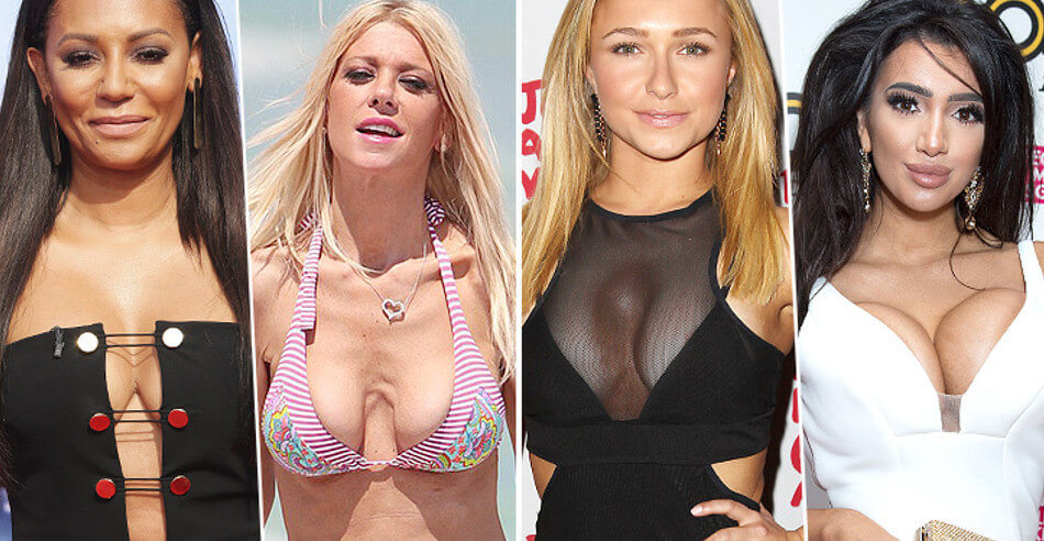 С неудачной маммопластикой нередко сталкиваются даже звезды, что уж говорить о простых смертных