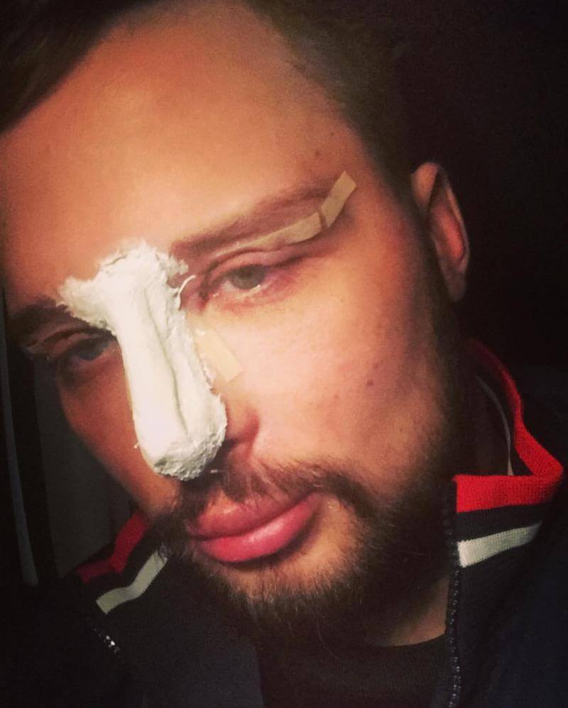 35-летний мужчина нацелился на славу «первого русского Кена»