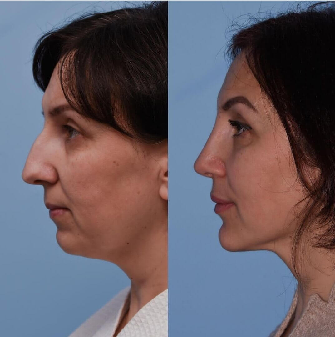 Комплексная имиджевая пластика преображает внешность до неузнаваемости