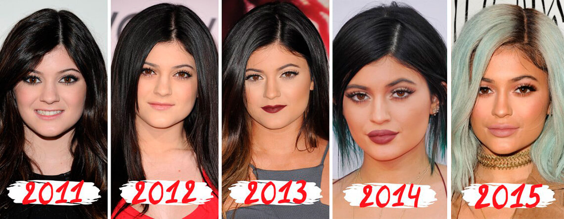 Кайли Дженнер сделала много пластических операций и косметических процедур в юном возрасте