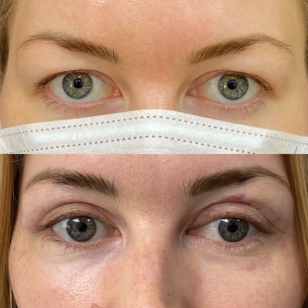 Ничто так&nbsp;не&nbsp;омолаживает, как&nbsp;распахнутый взгляд