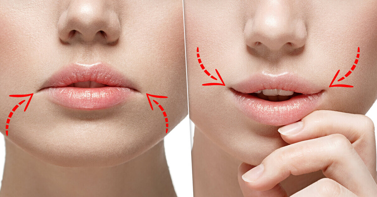 Схема проведения корнер-лифтинга максимально проста