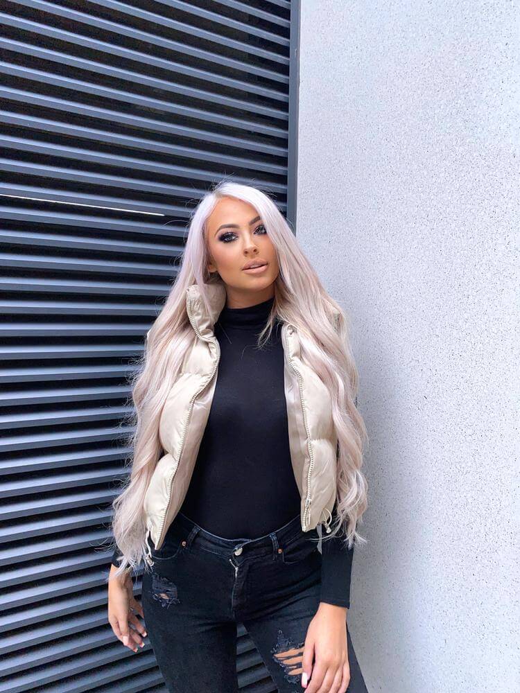 Работа моделью и тысячи подписчиков не смогли заставить Леони полюбить свое лицо. Надеемся, операция поможет ей обрести нос мечты