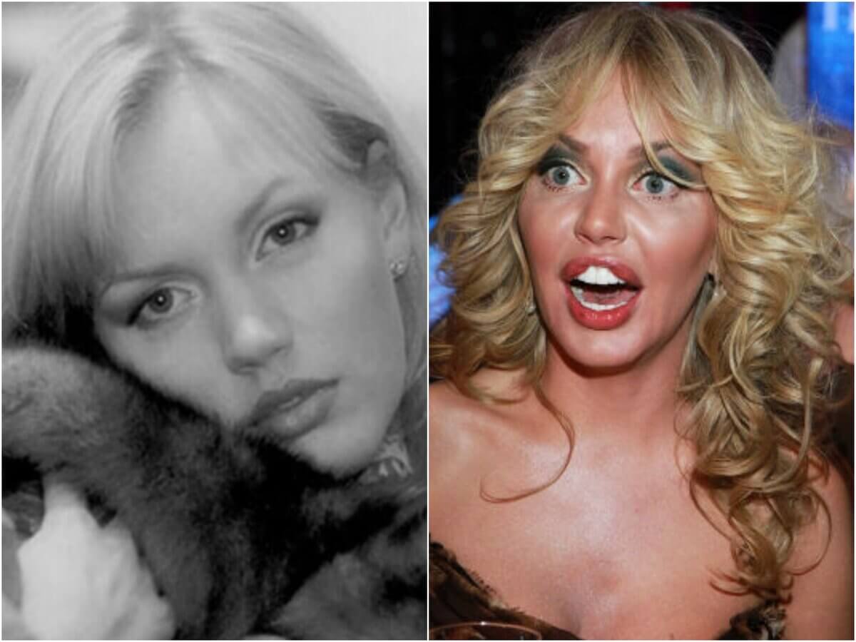 Маша Малиновская до и после пластики