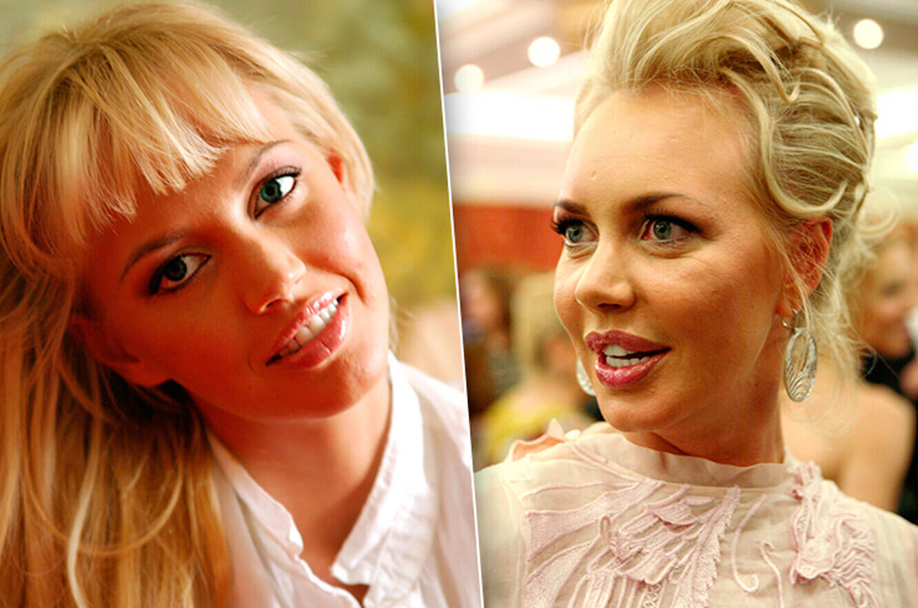 Маша Малиновская до и после пластики