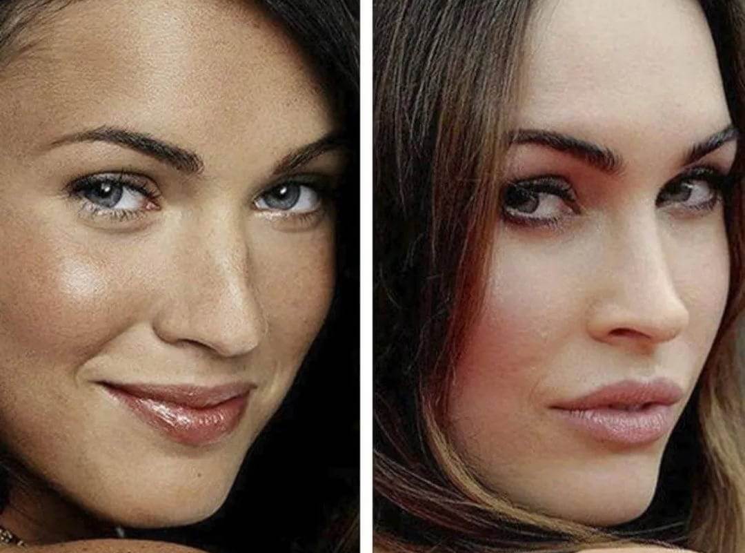 Меган Фокс призналась только в&nbsp;одной ринопластике