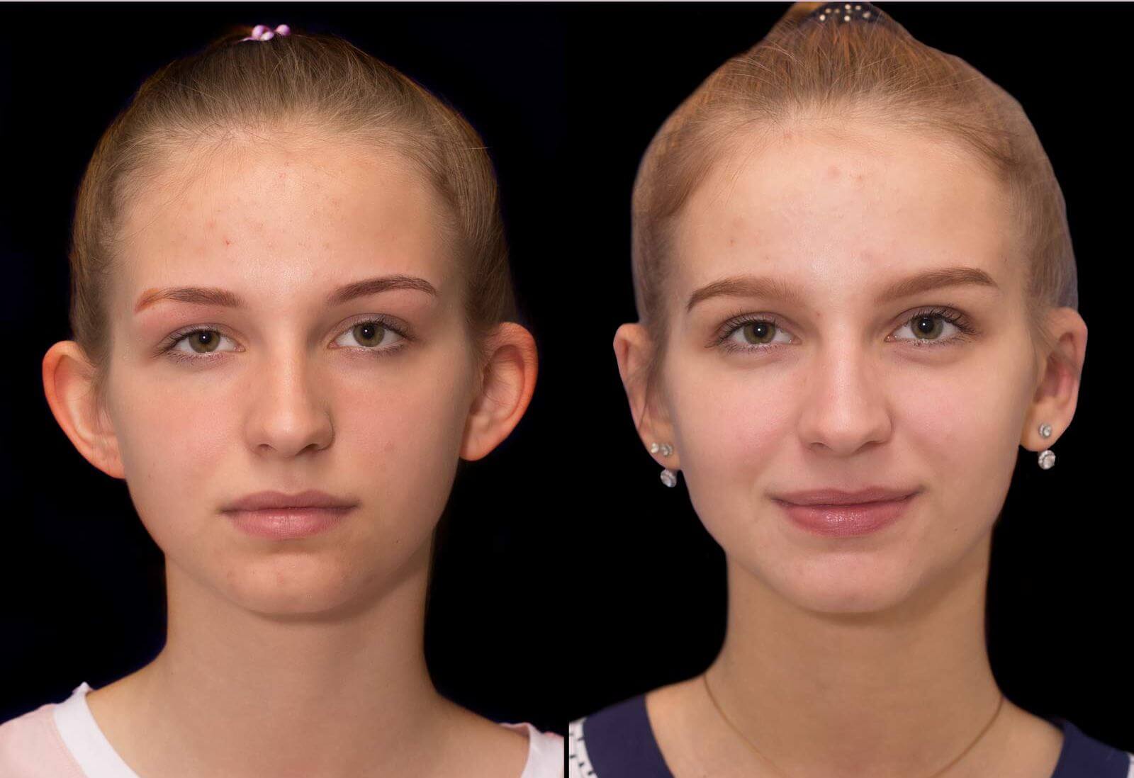 &hellip;и женскую