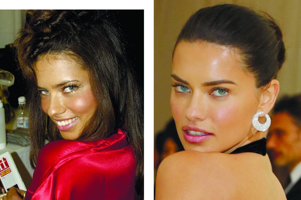 Адриана Лима до&nbsp;и&nbsp;после пластики
