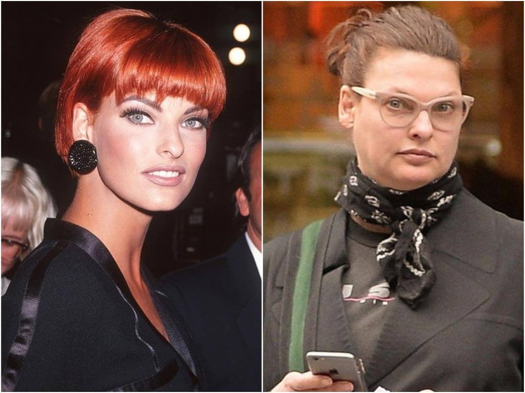 Линда Евангелиста до и после криолиполиза