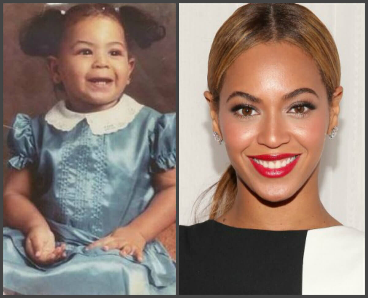 Отопластика пошла Бейонсе на пользу