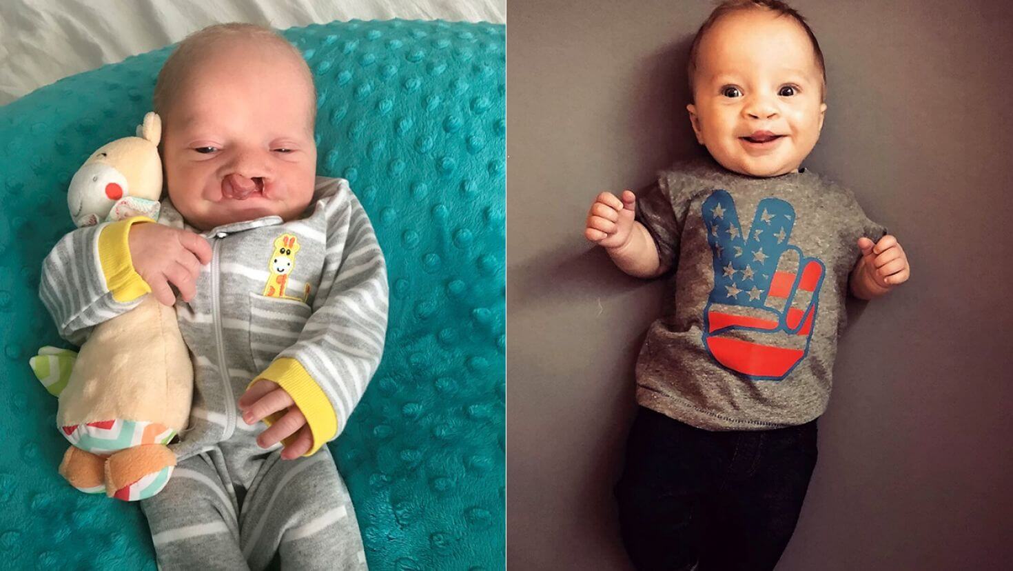 Современная медицина позволяет без следа устранять даже самые серьезные врожденные дефекты в развитии лицевых структур