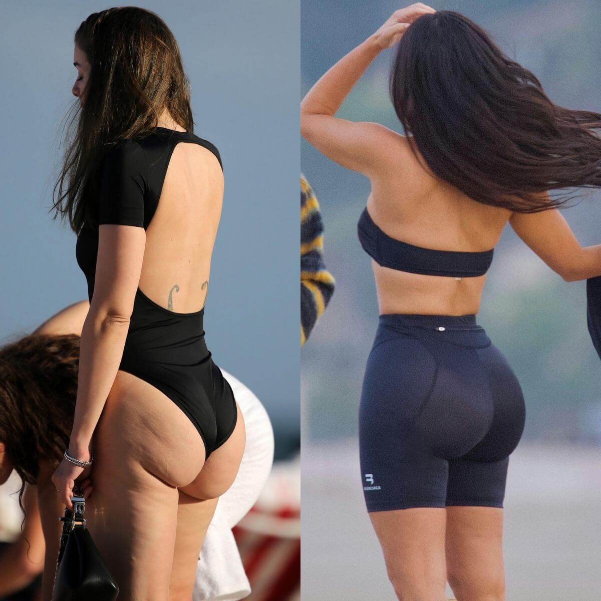 Вот так&nbsp;выглядит результат неудачной пластики ягодиц в&nbsp;исполнении Джулии Фокс