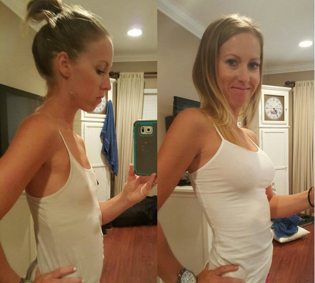 99% мужчин &ndash; за&nbsp;красивую пропорциональную грудь. И&nbsp;ее происхождение совершенно не&nbsp;имеет значения