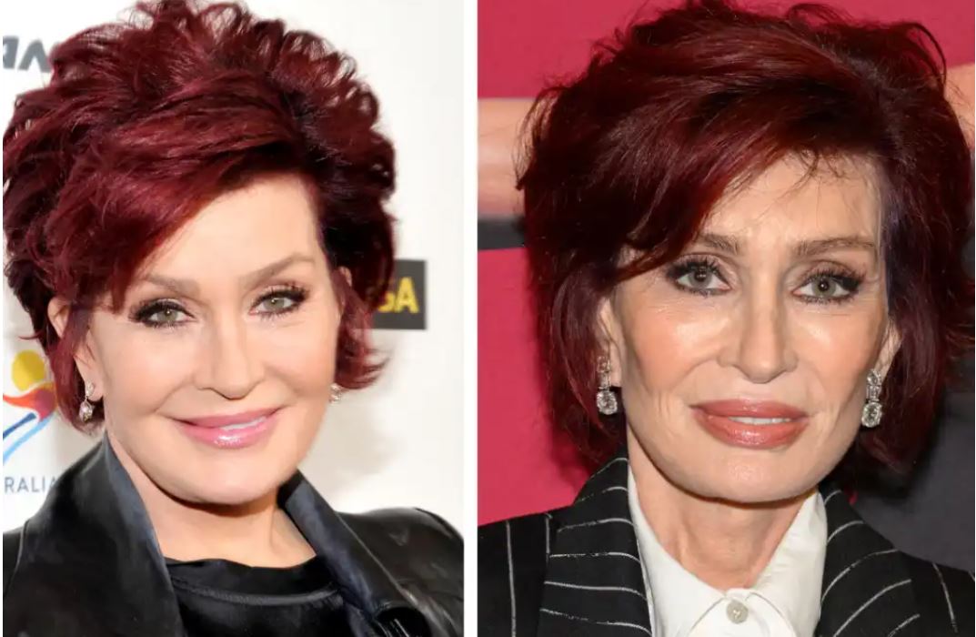 Шэрон Осборн – яркий пример обладательницы так называемого «Ozempic Face»