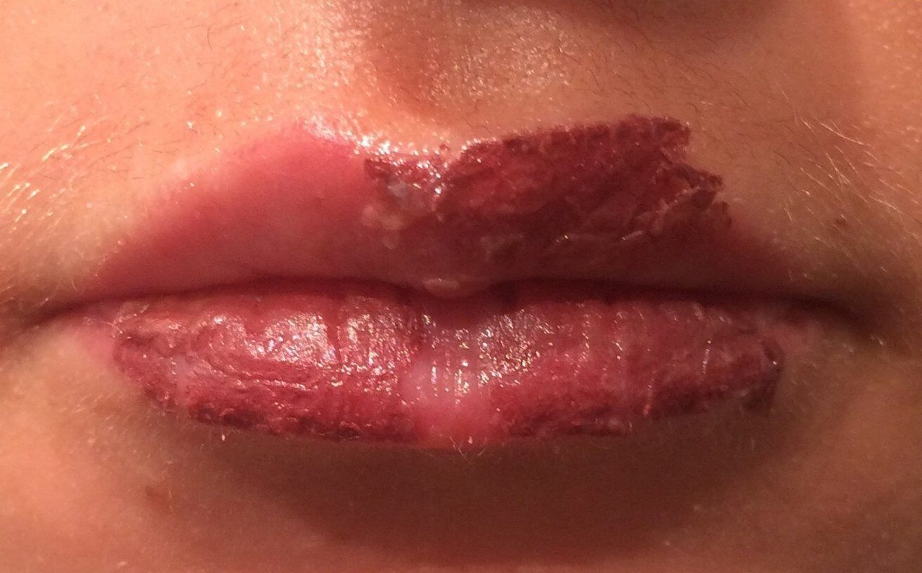 Тем, кто регулярно делает татуаж или другие косметологические процедуры с микротравмированием тканей лица, проще других заметить, что кожа стала восстанавливаться дольше