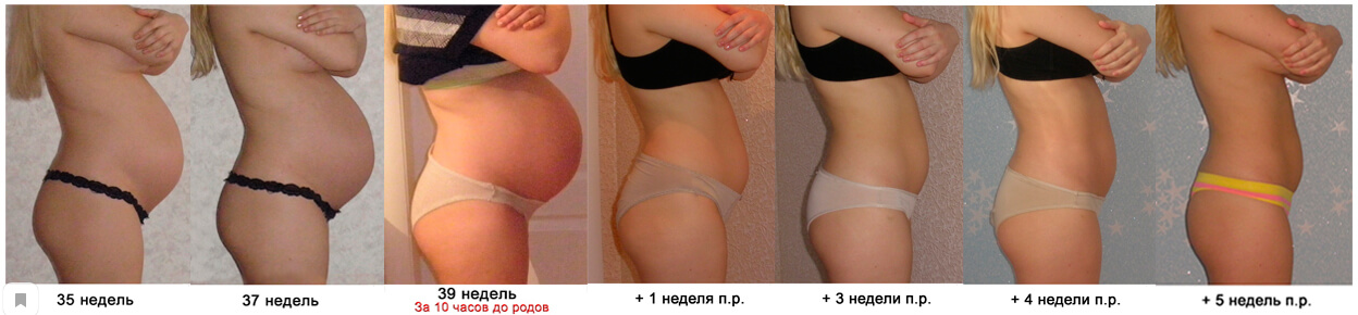 Живот во время беременности и&nbsp;после родов