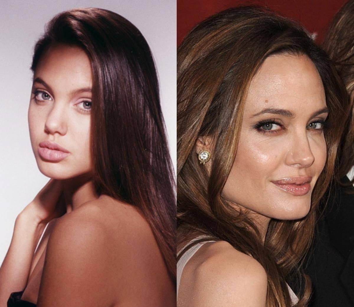 Анджелина Джоли до&nbsp;и&nbsp;после ринопластики