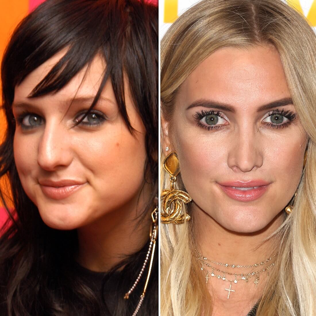 Эшли Симпсон до&nbsp;и&nbsp;после ринопластики