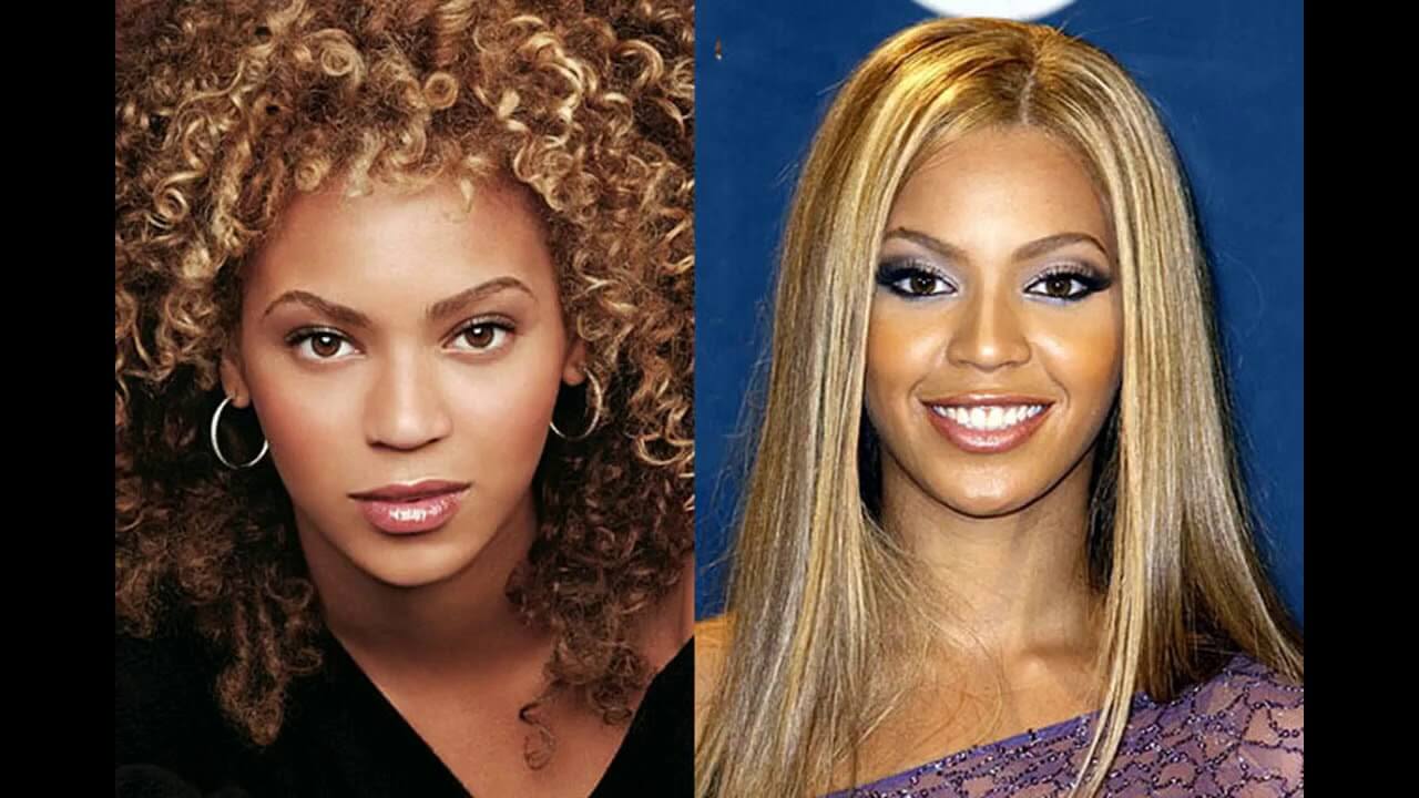 Бейонсе до и после ринопластики