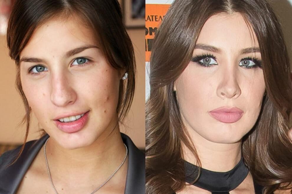 Кети Топурия до и после ринопластики