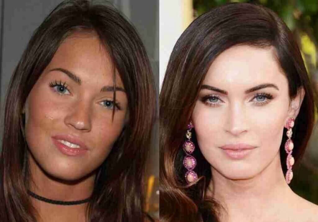 Меган Фокс до и после ринопластики