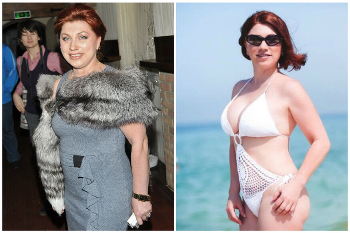 Роза Сябитова до и после пластики