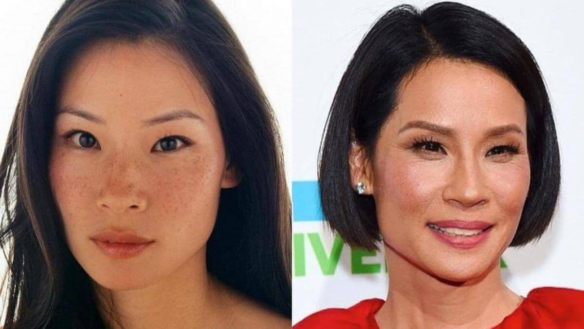 Люси Лью &ndash; образец мускульного старения лица