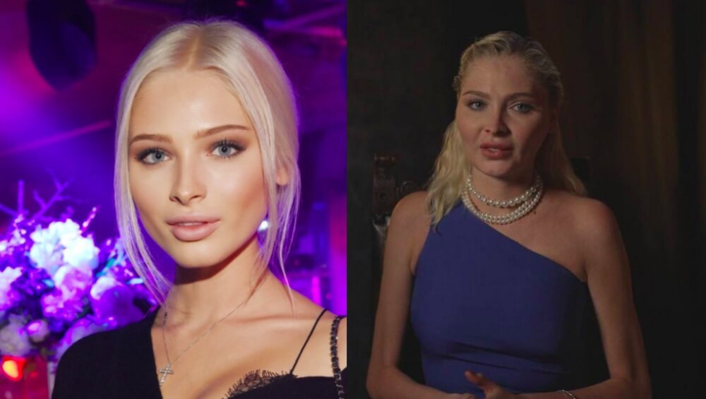 На последних фото и видео Алена действительно выглядит одутловатой и постаревшей. Изменит ли пластика положение дел?