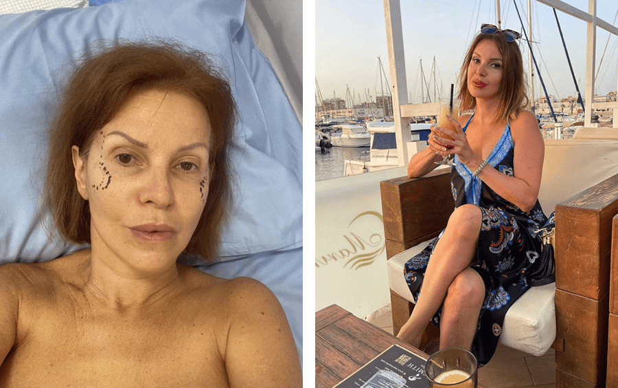 Отношение к&nbsp;пластике певица изменила, когда впервые прибегла к&nbsp;ней этим летом