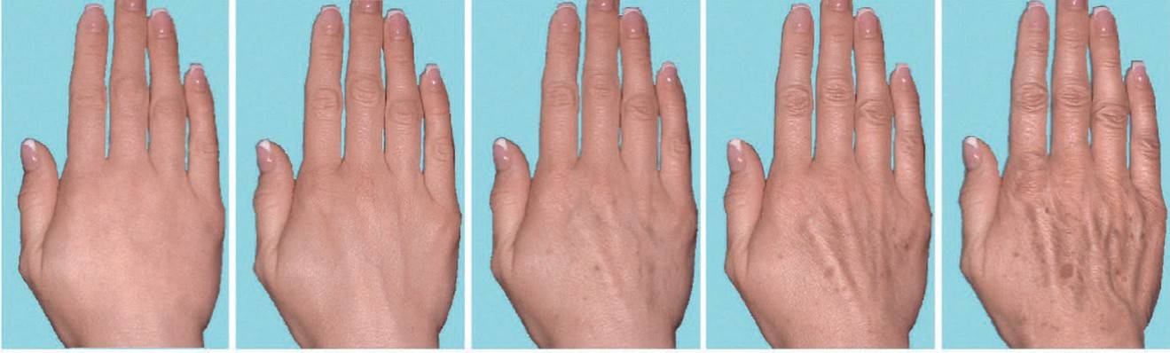 Без постоянного ухода руки стареют очень быстро