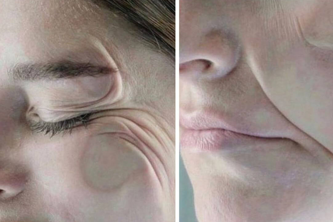 Во время сна на&nbsp;нашем лице образуются заломы, которые со&nbsp;временем могут превратиться в&nbsp;стойкие морщины