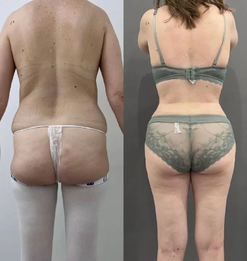 С помощью комплексной пластической операции можно решить целый ряд проблем за один раз